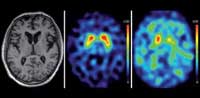 Medical isotopes