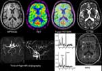 5th Symphosiom on Medical Radioisotopes