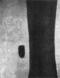 First Belgian military radiograph, April 1896. 